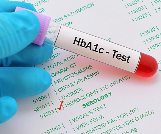 HbA1c Levels Influence Life Insurance Premiums